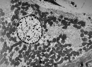 normal mucosa - stomach - parietal cell